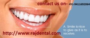 porcelain composite veneers