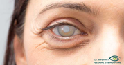 Best Eye Hospital in Patiala