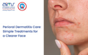 Looking for Dermatitis Care Simple Treatments for a cleare face